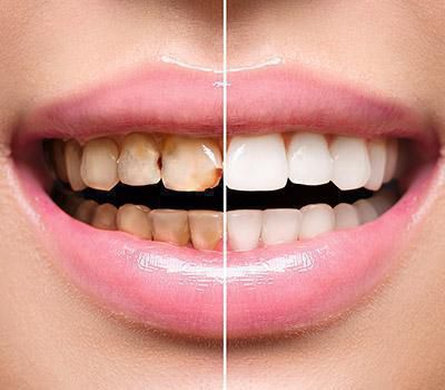 Restorative Dentistry Restorative Dentistry